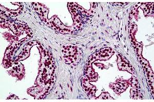 Human Prostate: Formalin-Fixed, Paraffin-Embedded (FFPE) (SMARCA4 Antikörper  (AA 2-14))