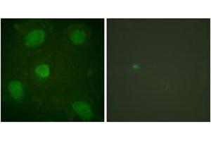 Immunofluorescence analysis of HeLa cells, using Hic-5 (Ab-60) Antibody.