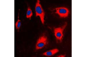Immunofluorescent analysis of TCTP staining in CCRFCEM cells. (TPT1 Antikörper  (Center))