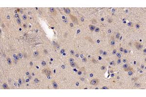 Immunohistochemistry (IHC) image for anti-Dimethylarginine Dimethylaminohydrolase 2 (DDAH2) (AA 31-265) antibody (ABIN7435682)