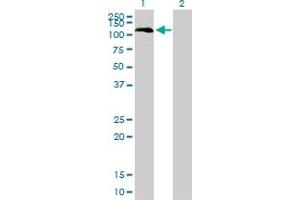 Western Blot analysis of BUB1 expression in transfected 293T cell line by BUB1 monoclonal antibody (M01), clone 4C3-4C9. (BUB1 Antikörper  (AA 1-1085))