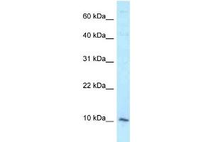 WB Suggested Anti-DAP Antibody Titration: 1. (DAP Antikörper  (Middle Region))