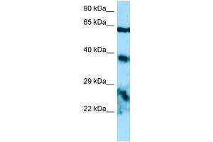 WB Suggested Anti-EPYC Antibody Titration: 1. (EPYC Antikörper  (Middle Region))