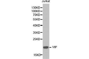 Western blot analysis of extracts of Jurkat cell lines, using VIP antibody. (Vip Antikörper  (AA 31-170))