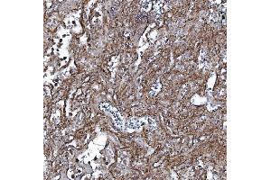 IHC analysis of EHD3 using anti-EHD3 antibody (ABIN7602777). (EHD3 Antikörper  (C-Term))