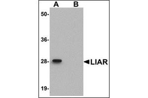Western blot analysis of LIAR in mouse kidney tissue lysate with this product at 1 μg/ml in (A) the absence and (B) the presence of blocking peptide. (ANKRD54 Antikörper  (C-Term))