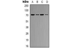 Western blot analysis of KEAP1 expression in K562 (A), Hela (B), mouse heart (C), mouse brain (D) whole cell lysates. (KEAP1 Antikörper)