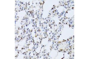 Immunohistochemistry of paraffin-embedded rat lung using MAPK3 Antibody (ABIN5970057) at dilution of 1/100 (40x lens).