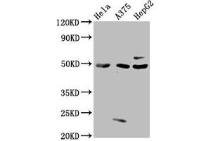 Western Blot Positive WB detected in: Hela whole cell lysate, A375 whole cell lysate, HepG2 whole cell lysate All lanes: STK24 antibody at 3 μg/mL Secondary Goat polyclonal to rabbit IgG at 1/50000 dilution Predicted band size: 50, 48 kDa Observed band size: 50 kDa (STK24 Antikörper  (AA 1-431))
