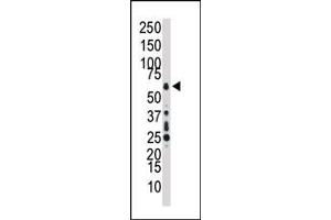 Western blot analysis of anti-TAK1 Pab (ABIN392466 and ABIN2842053) in HL60 cell lysate. (TR4 Antikörper  (C-Term))