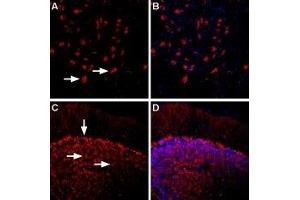 Expression of β1-Adrenoceptor in rat and mouse brain - Immunohistochemical staining of rat dorsal raphe nucleus and mouse cerebellum using Anti-β1-Adrenergic Receptor (extracellular) Antibody (ABIN7042902, ABIN7043924 and ABIN7043925), (1:400). (ADRB1 Antikörper  (2nd Extracellular Loop))