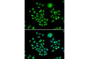 Immunofluorescence (IF) image for anti-HIV-1 Rev Binding Protein (HRB) antibody (ABIN1980310)