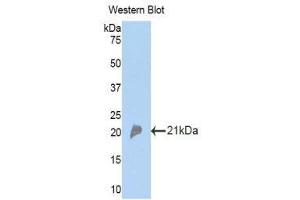 Western Blotting (WB) image for anti-Complement Factor P (CFP) (AA 310-459) antibody (ABIN3207871) (CFP Antikörper  (AA 310-459))