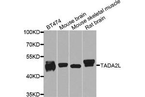 Western blot analysis of extracts of various cells, using TADA2A antibody. (TADA2L Antikörper)
