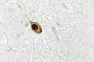 Immunohistochemistry (IHC) analyzes of Zic1/2/3 antibody in paraffin-embedded human brain tissue. (ZIC1 Antikörper)