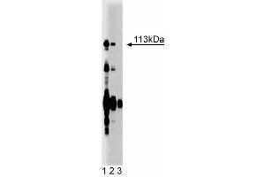 Western blot analysis of Itch on rat liver lysate. (ITCH Antikörper  (AA 114-220))