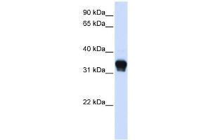 CK1 alpha 1 antibody used at 1 ug/ml to detect target protein. (CK1 alpha 1 (C-Term) Antikörper)