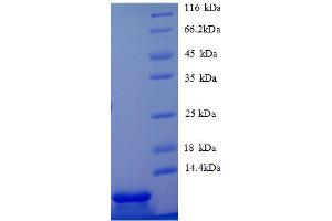 SDS-PAGE (SDS) image for Chemokine (C-X-C Motif) Ligand 5 (CXCL5) (AA 46-117), (partial) protein (His tag) (ABIN1046743) (CXCL5 Protein (AA 46-117, partial) (His tag))