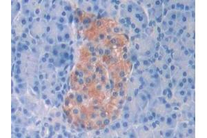 Immunohistochemistry (IHC) image for anti-serpin Peptidase Inhibitor, Clade A (Alpha-1 Antiproteinase, Antitrypsin), Member 6 (SERPINA6) (AA 218-378) antibody (ABIN7437137)
