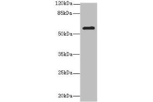 Western blot All lanes: MMP19antibody at 2. (MMP19 Antikörper  (AA 209-508))