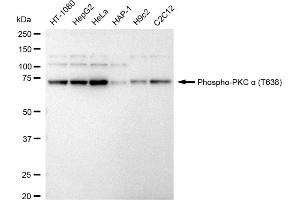 Western blotting analysis using Phospho-PKC alpha (T638) antibody (ABIN7799987).