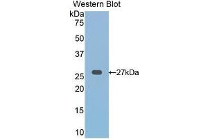 Detection of Recombinant FZD1, Human using Polyclonal Antibody to Frizzled Homolog 1 (FZD1) (FZD1 Antikörper  (AA 117-322))