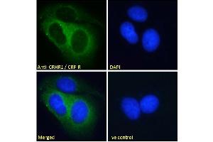 ABIN190893 Immunofluorescence analysis of paraformaldehyde fixed MCF7 cells, permeabilized with 0. (CRHR1 Antikörper  (AA 250-263))