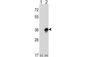 Western Blotting (WB) image for anti-Myelin Protein Zero (MPZ) antibody (ABIN3003838) (MPZ Antikörper)