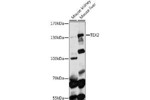 Western blot analysis of extracts of various cell lines, using TEX2 antibody (ABIN7270775) at 1:1000 dilution. (TEX2 Antikörper  (AA 915-1134))