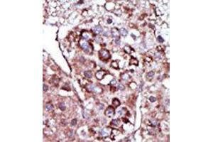 Image no. 2 for anti-Diacylglycerol Kinase, zeta (DGKZ) (C-Term) antibody (ABIN360519) (DGKZ Antikörper  (C-Term))