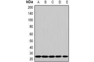 Western blot analysis of RPS5 expression in Hela (A), HepG2 (B), Jurkat (C), mouse spleen (D), mouse lung (E) whole cell lysates. (RPS5 Antikörper)
