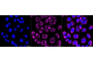 Immunocytochemical staining of HT- cells with PTPN1/2 antibody (ABIN7800964), 1:1,000). (Rekombinanter PTPN1/PTPN2 Antikörper)
