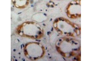 Immunohistochemistry (IHC) image for anti-Bone Morphogenetic Protein Receptor, Type II (serine/threonine Kinase) (BMPR2) (AA 27-150) antibody (ABIN7439651)