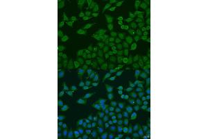 Immunofluorescence analysis of U2OS cells using PLG4C antibody (ABIN6132097, ABIN6145730, ABIN6145731 and ABIN6223698) at dilution of 1:100. (PLA2G4C Antikörper  (AA 1-189))