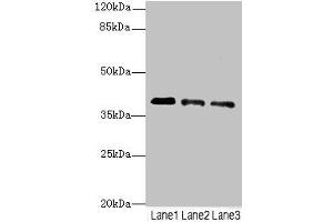 Western blot All lanes: RP2antibody at 3. (RP2 Antikörper  (AA 1-350))