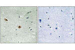 Immunohistochemical analysis of paraffin-embedded human brain tissue using Retinoblastoma (Phospho-Ser608) antibody (left)or the same antibody preincubated with blocking peptide (right). (Retinoblastoma 1 Antikörper  (pSer608))