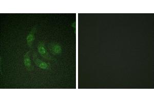 Peptide - +Immunofluorescence analysis of HepG2 cells, using CaMK4 (Ab-196/200) antibody. (CAMK4 Antikörper  (Thr196))
