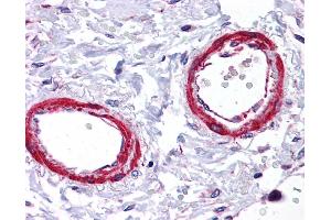 Immunohistochemistry (IHC) image for anti-Sirtuin 5 (SIRT5) (Middle Region) antibody (ABIN2778620) (SIRT5 Antikörper  (Middle Region))
