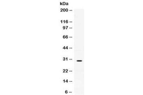 Mast Cell Tryptase Antikörper