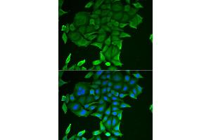 Immunofluorescence analysis of HeLa cells using CD84 antibody (ABIN5973833). (CD84 Antikörper)