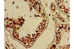 Immunohistochemistry of paraffin-embedded human testis tissue using ABIN7152561 at dilution of 1:100 (BRIP1 Antikörper  (AA 66-243))