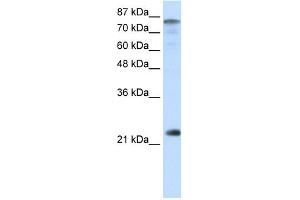 WB Suggested Anti-NFYB Antibody Titration:  0. (NFYB Antikörper  (N-Term))