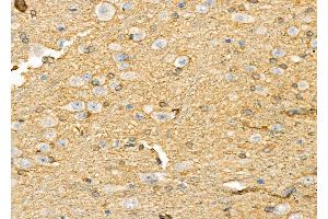 ABIN6265732 and ABIN6278120 at 1/100 staining Rat brain tissue by IHC-P. (TRIM29 Antikörper  (Internal Region))