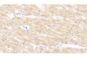 Detection of BMP2 in Human Cardiac Muscle Tissue using Polyclonal Antibody to Bone Morphogenetic Protein 2 (BMP2) (BMP2 Antikörper  (AA 24-396))