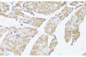 Immunohistochemistry of paraffin-embedded Mouse heart using ASMT Polyclonal Antibody at dilution of 1:100 (40x lens).