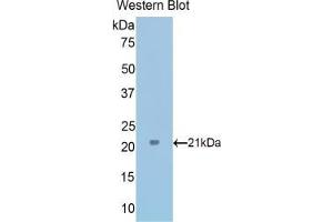 Western blot analysis of the recombinant protein. (TPT1 Antikörper  (AA 1-172))