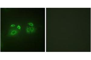 Immunofluorescence (IF) image for anti-Arrestin, beta 1 (ARRB1) (AA 369-418) antibody (ABIN2888645) (beta Arrestin 1 Antikörper  (AA 369-418))