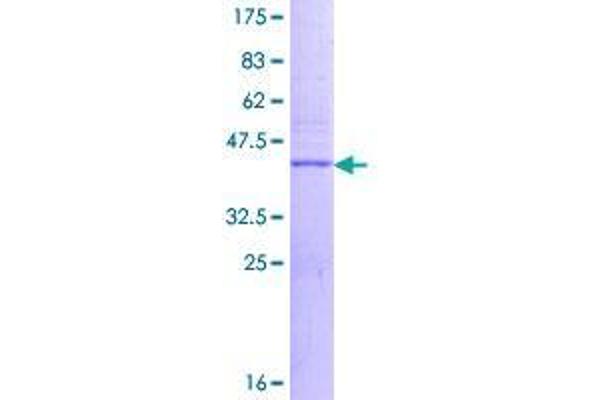 VPREB3 Protein (AA 1-123) (GST tag)