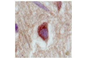SLC18A1 (VMAT1) in the cortex of human brain was detected using SLC18A1 antibody at a dilution of 5-10 ug/ml and stained with HRP/DAB brown color stain. (SLC18A1 Antikörper  (Middle Region))