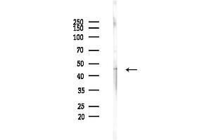 anti-Apolipoprotein L, 2 (APOL2) (C-Term) antibody